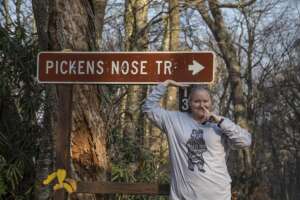 Pickens Nose Sign